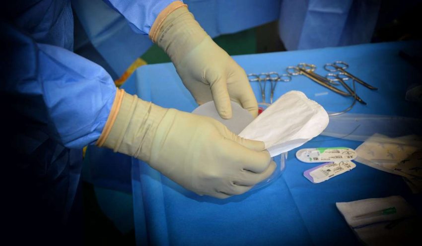 Surgeon preparing equipment for surgery, birthmark removal