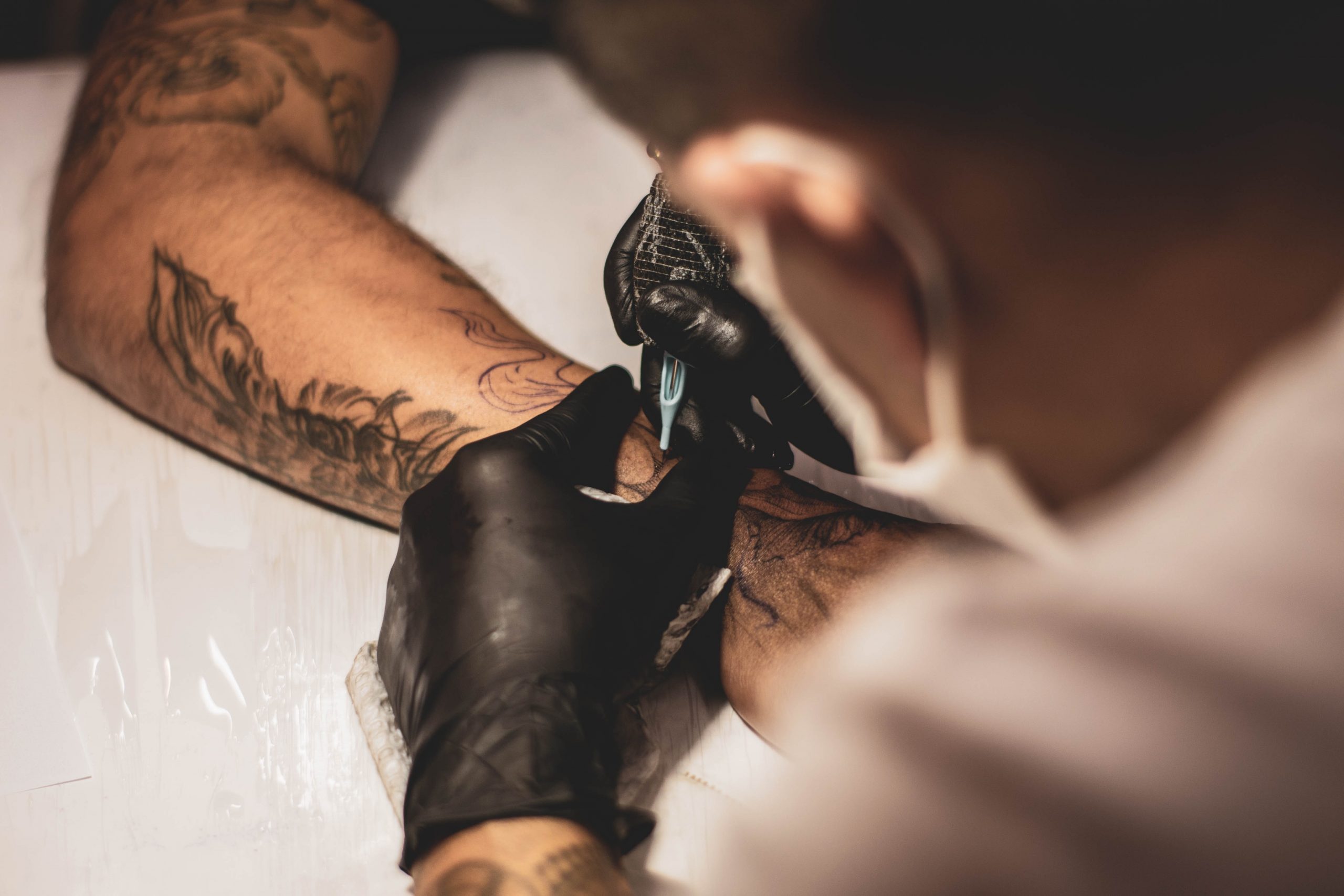 Can All Tattoos Be Removed? 6 Things You Should Know - Dr Nathan Holt