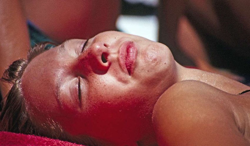 Closeup of sunburnt person, still sunbathing