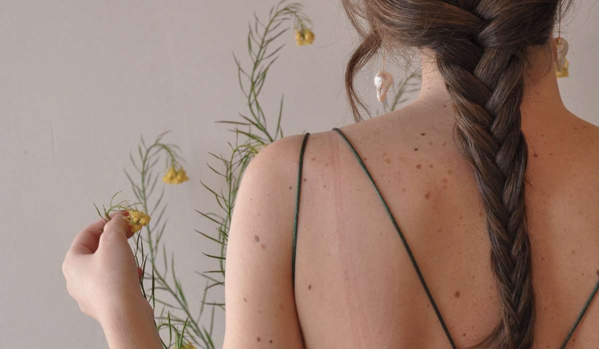 Person with hair tied back faces away from camera, touching plants against a white backdrop, birthmarks on back